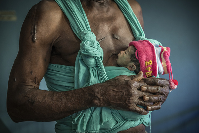 Nigerian father holding his newborn in Kangaroo Mother Care