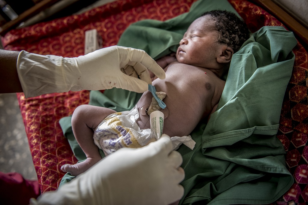 Baby having cord treated with chlorhexidine